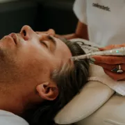 Le Microneedling 