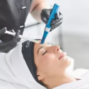 Microneedling