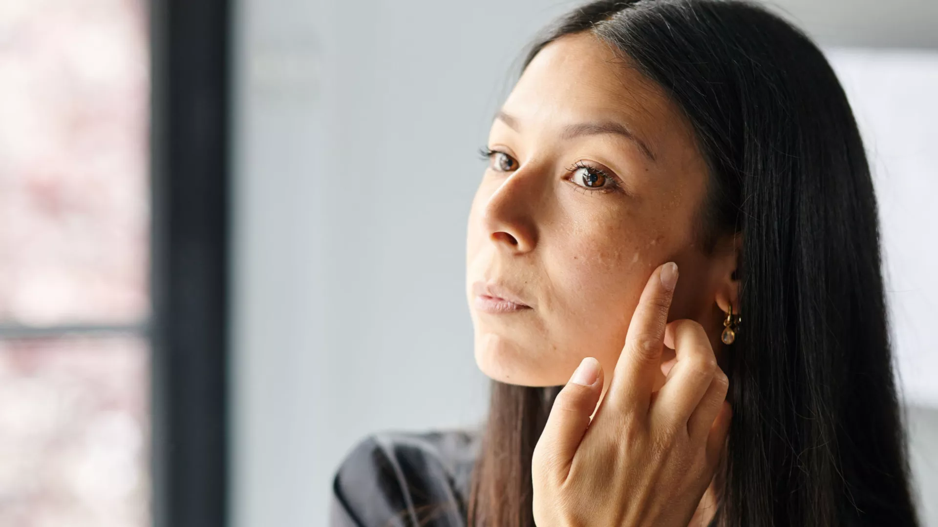 Skin resilience : la priorité des professionnels de la peau en 2026