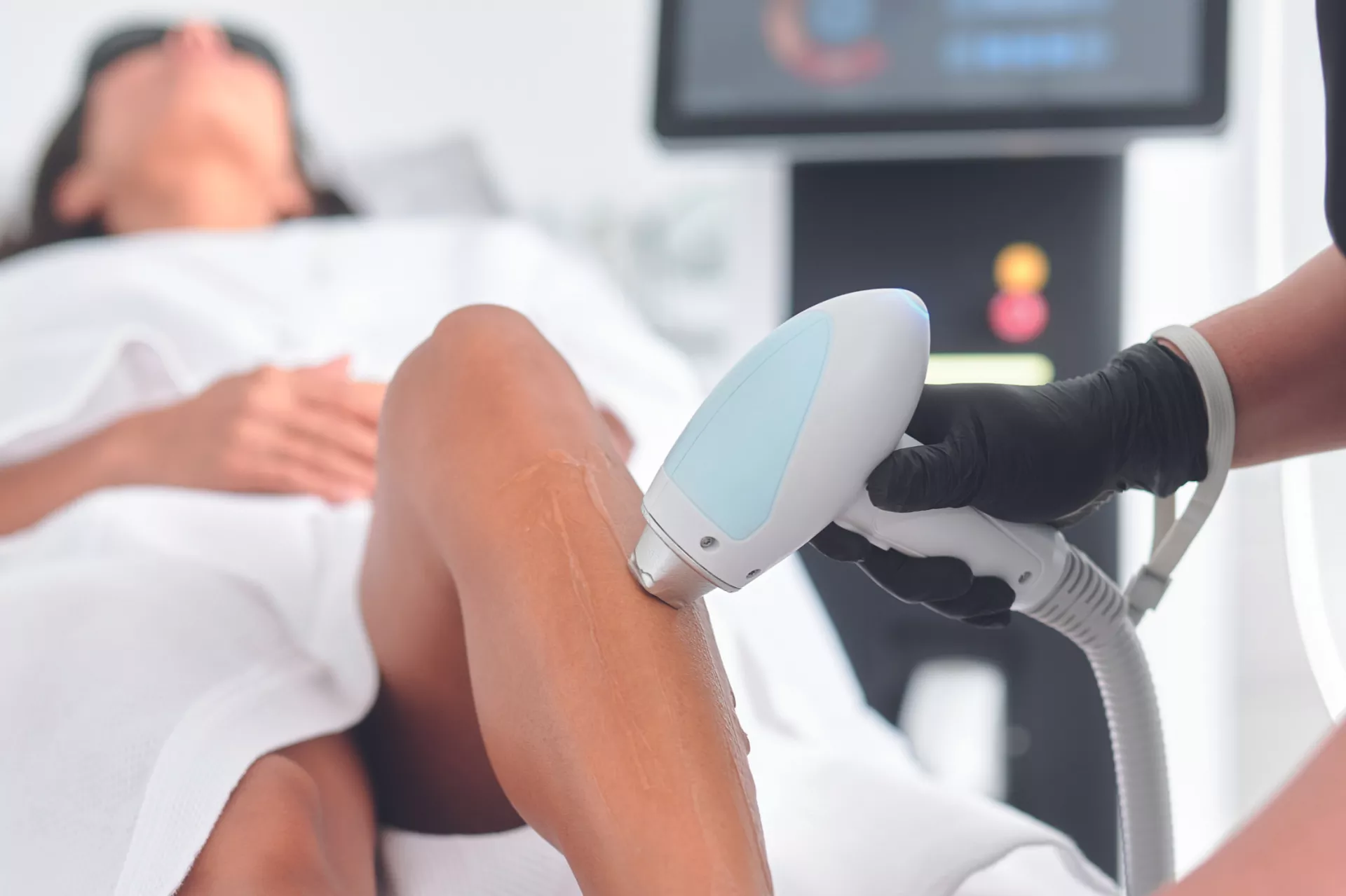 Anticiper dès maintenant l’été : le bon timing pour les traitements laser