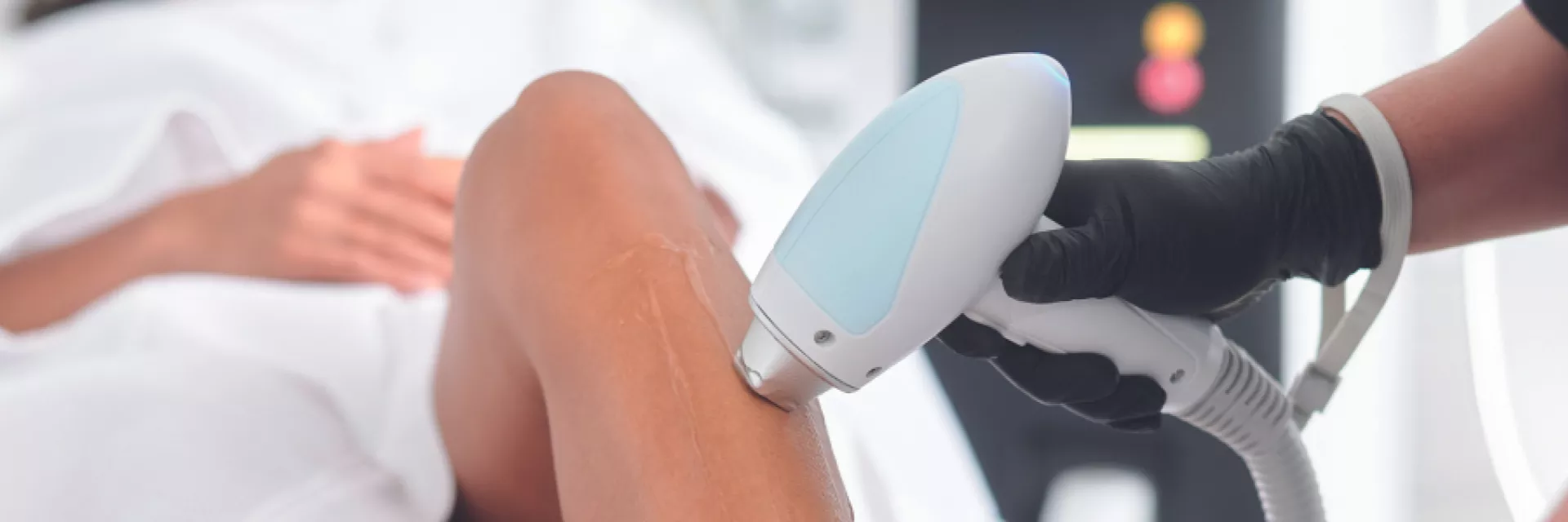 Laserontharing vóór de zomer: de juiste timing voor veilige en doeltreffende resultaten