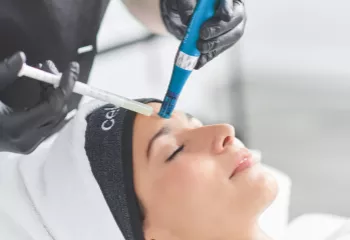 microneedling-professionnel