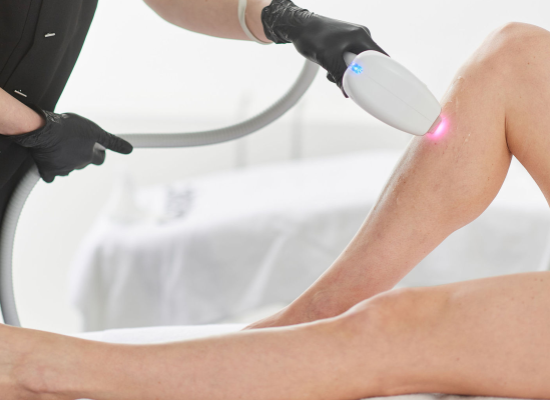 Epilation définitive