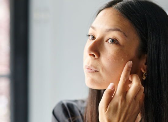 Skin resilience : la priorité des professionnels de la peau en 2026