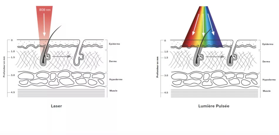 Wat is het verschil met gepulseerd licht?
