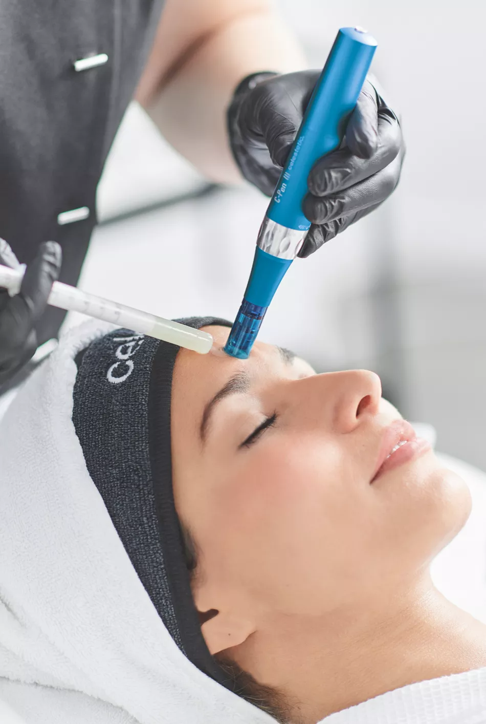 3. Microneedling