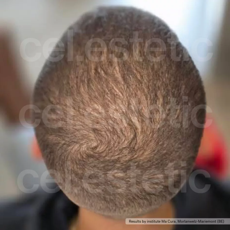بعد